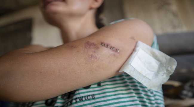 Antalya'da eşi tarafından bıçaklanan kadın öldürülme korkusuyla yaşıyor 