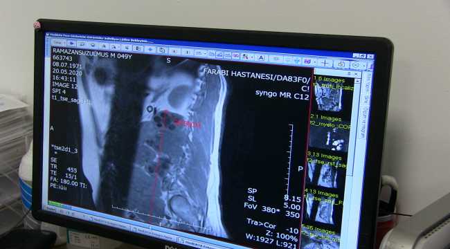 Bel ağrısı şikayetiyle doktora müracaat eden kişi 