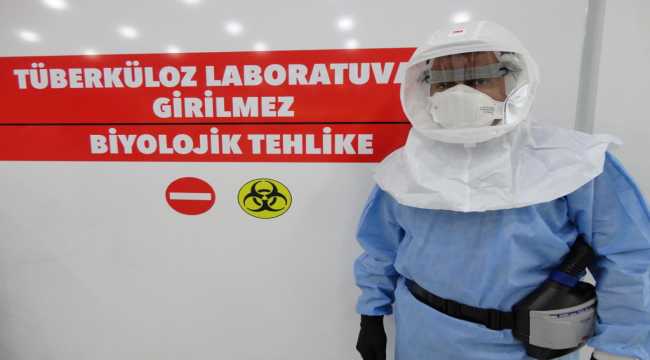 Akdeniz Üniversitesinden tüberküloz hastalığına erken tanı sağlayacak yöntem
