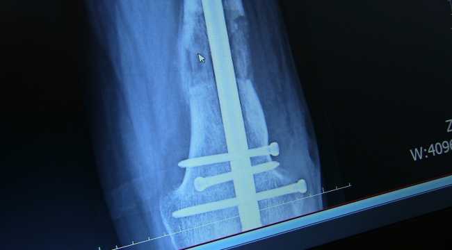 31 yıldır hasret kaldığı ayakkabılarına kavuşmanın mutluluğunu yaşıyor