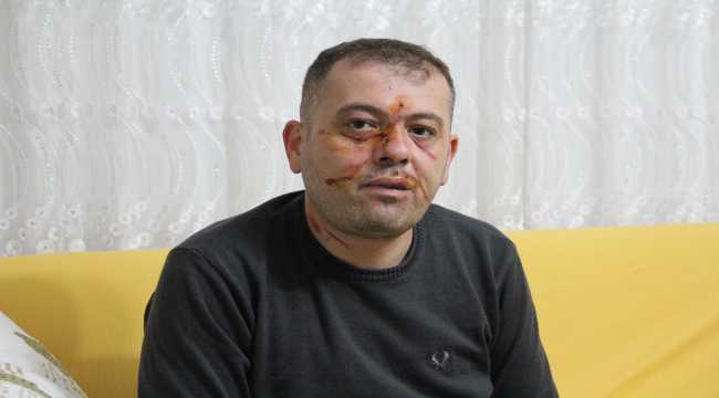 Hasta nakil aracının sürücüsü darp edildi