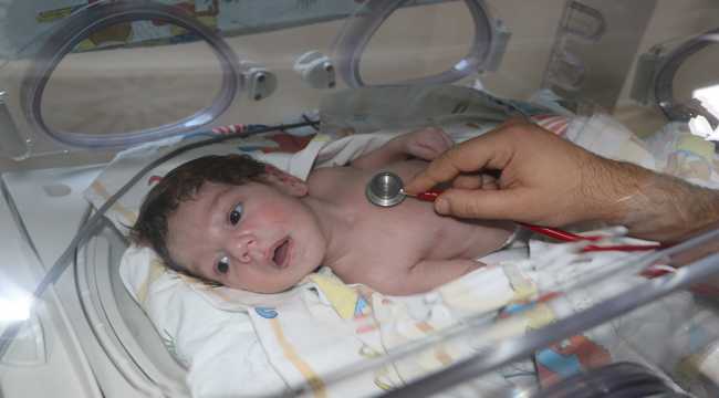 Kalp hastası Mahmut bebek yaşama tutundu