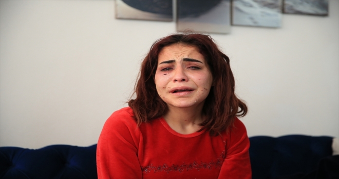 Antalya'da eski erkek arkadaşı tarafından darbedildiğini öne süren Beyza Yurttaş olayı anlattı: