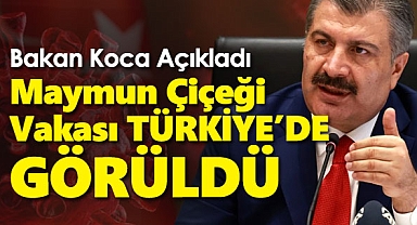 Bakan Koca Açıkladı! 'Maymun Çiçeği Vakası Türkiye'de Görüldü'