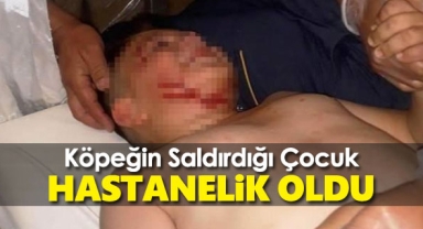 Köpeğin saldırdığı çocuk hastanelik oldu