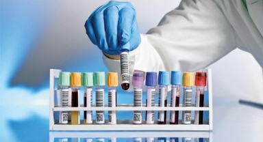 Kolon kanserine kan testi taraması