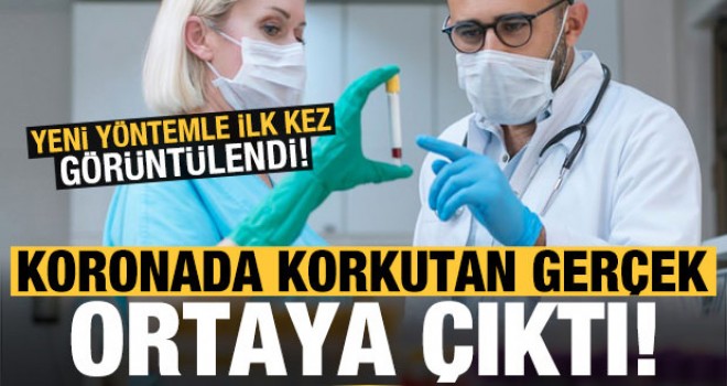 Koronada ürküten gerçek ortaya çıktı! Yeni yöntemle ilk kez görüntülendi!