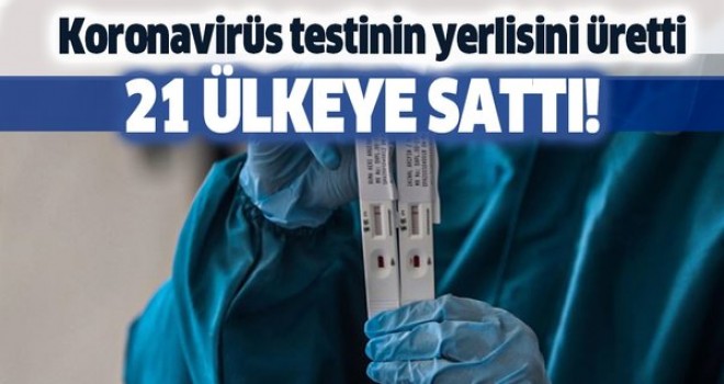 Kovid-19 tarama testinin yerlisini üretti, 21 ülkeye sattı