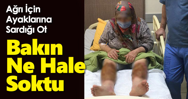 Ağrıyı geçirmek için ayaklarına sardığı ot hayatının şokunu yaşattı!