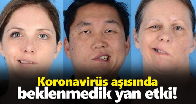 Koronavirüs aşısında beklenmedik yan etki!
