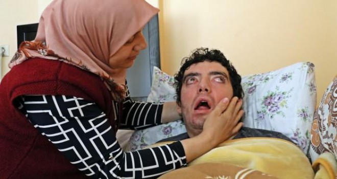 6 yıldır gözlerini kırpamıyor