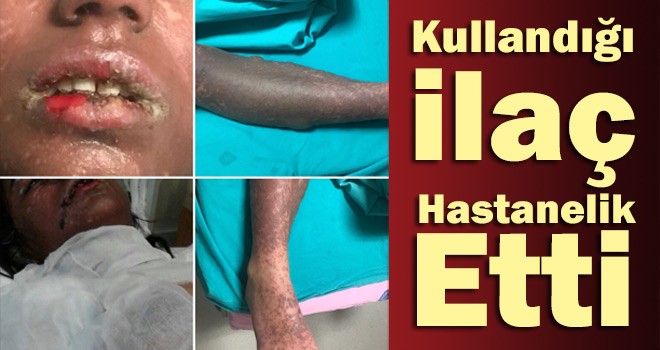Genç Kızın Kullandığı İlaç Hastanelik Etti