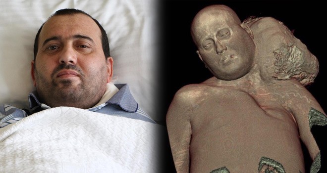 Türkiye'ye Geldiğinde Bu Haldeydi