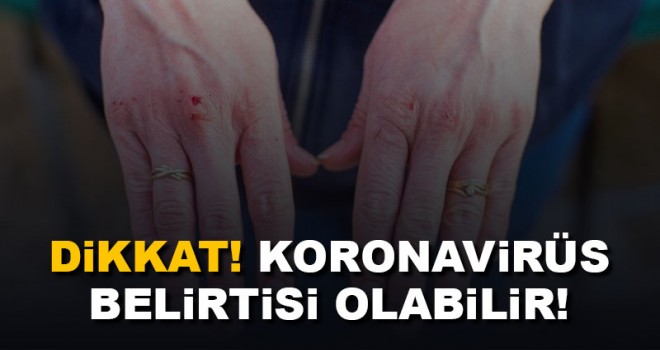 Prof. Dr. Oğuztürk uyardı: Covid-19 belirtisi olabilir