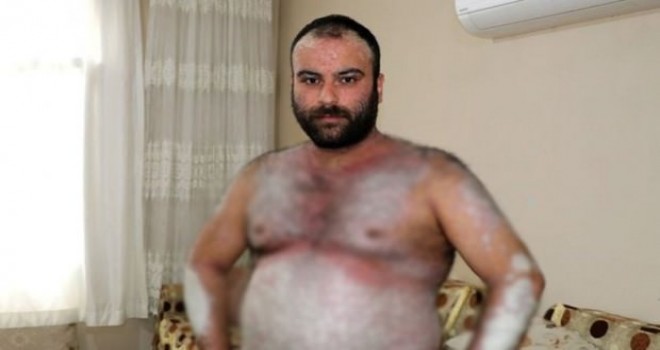 Kimse korkmasın diye dışarı çıkmıyor