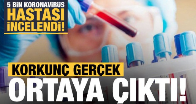 5 bin koronavirüs hastası incelendi! Korkunç gerçek ortaya çıktı
