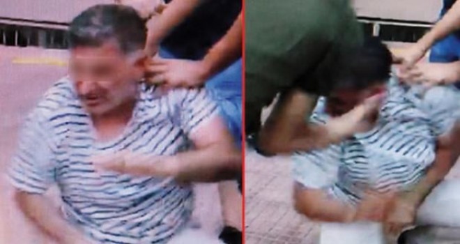 Ankara'da Sokak Ortasında Hadım Edildi