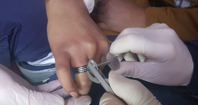 Parmağa sıkışan yüzük 112 ekiplerince çıkarıldı