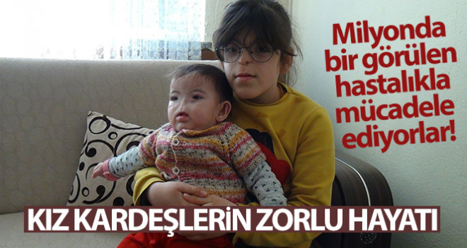 Doğuştan Burunları Yok! Milyonda Bir Görülüyor...