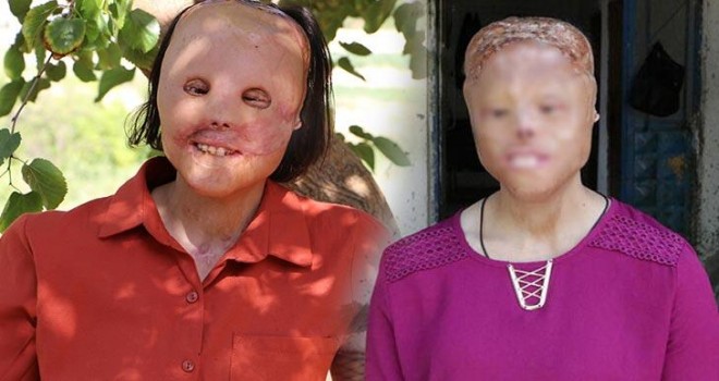 Doku nakli yapılan Leyla hayata yeniden tutundu